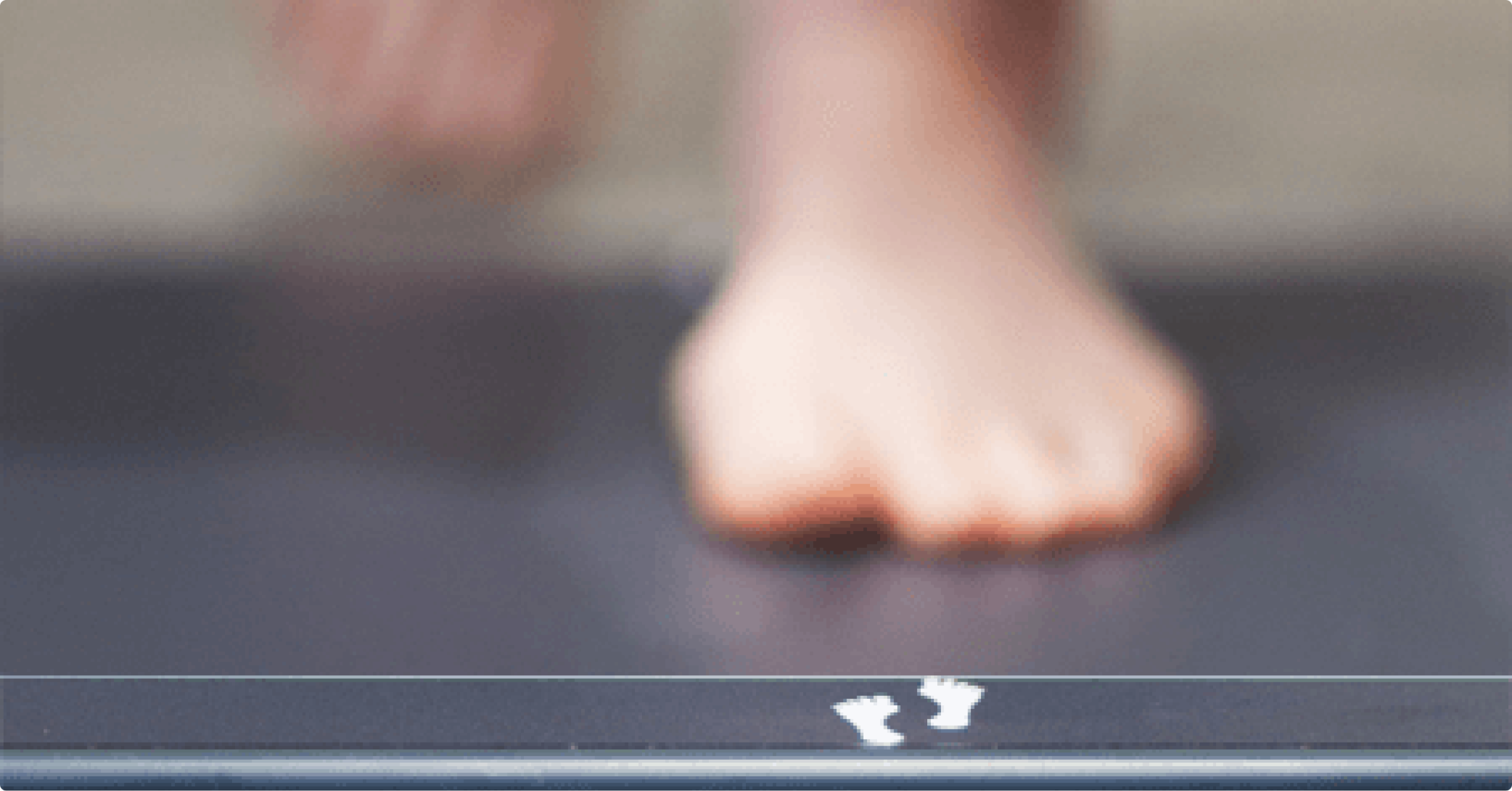 Gait analysis using dynamic footscan