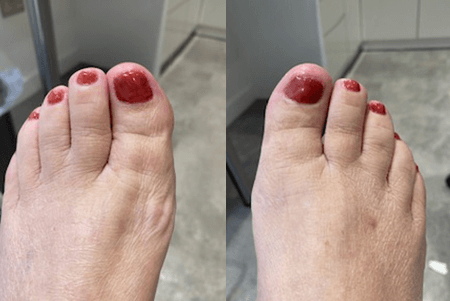 After reconstructed nail and gel polish applied