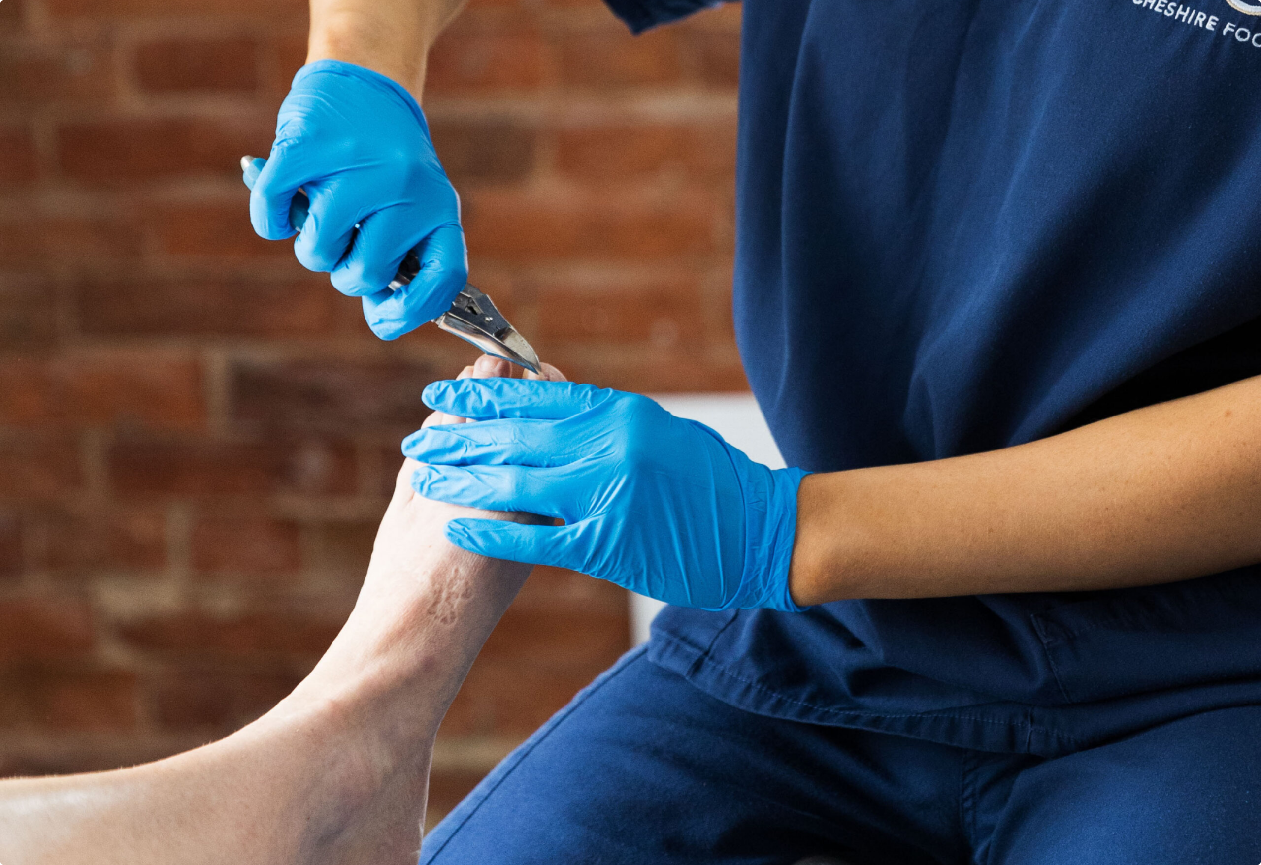 Ingrowing toenail treatment
